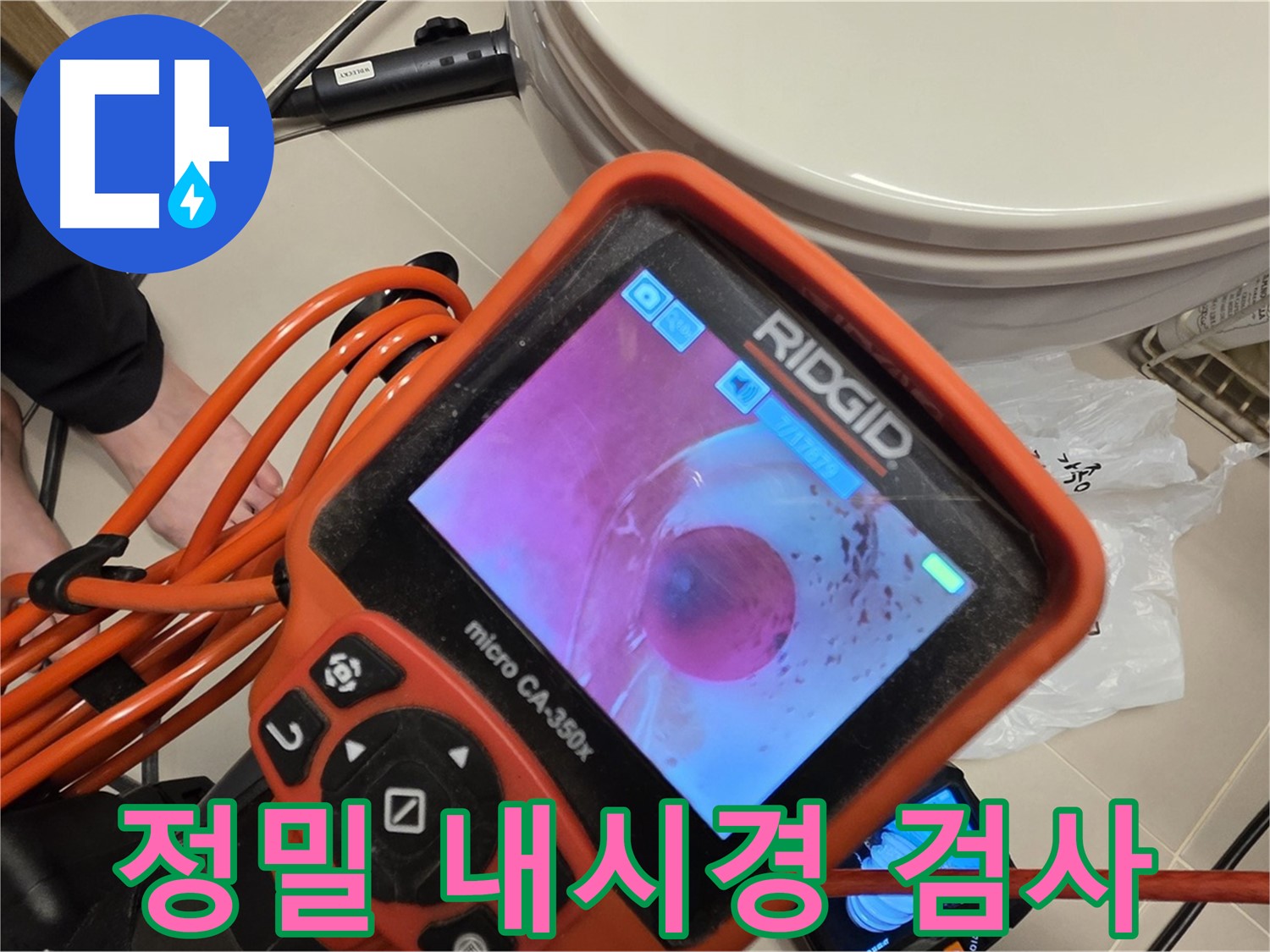 정밀 내시경 검사 - 꼼꼼한 검사가 중요합니다.
